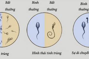 4 loại thực phẩm gây hại cho tinh trùng nam giới cần thận trọng
