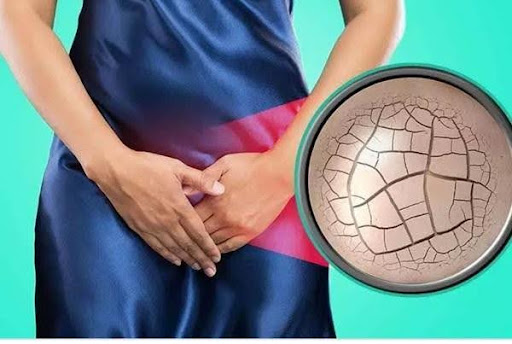 Những thay đổi của vùng kín tuổi ngoài 40: Ảnh hưởng và biện pháp khắc phục
