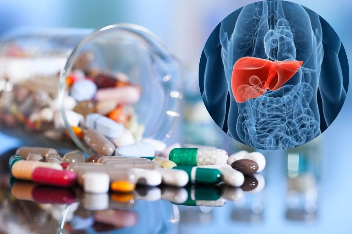 Làm gì để tránh tổn thương gan do thuốc gây ra?