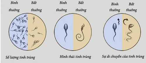 4 loại thực phẩm gây hại cho tinh trùng nam giới cần thận trọng